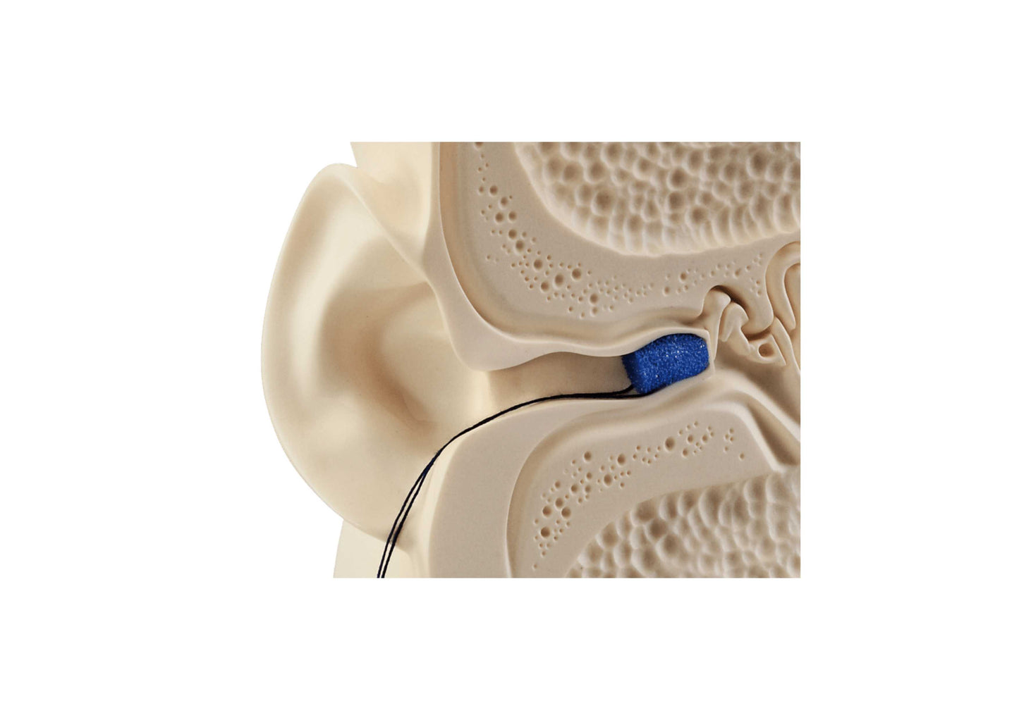 Afdrukwatjes 11mm - Detax